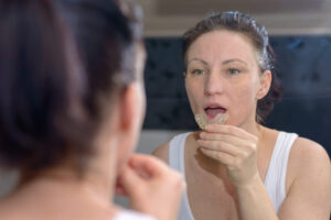 Woman looking frustrated while putting on her mouthguard in front of the mirror, depicting a situation where the mouthguard is not helping with teeth grinding